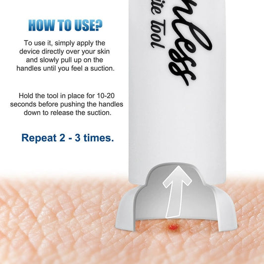 🦟 Experience Instant Relief  ✨ Ultimate Bite & Sting Relief Tool - For Itch-Free, Comfortable Days!