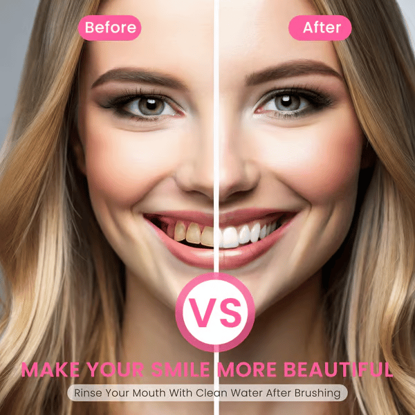 🔥BodyAccelProbiotic Whitening Toothpaste, Free of Fluoride, Nicotinamide, Anti plaque
