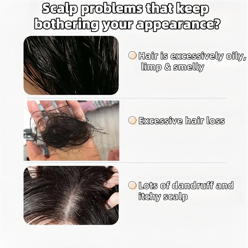 Anti-Hair Fall Shampoo